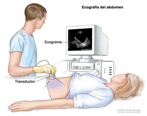Ecografía abdominal