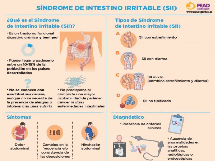 Síndrome de intestino irritable