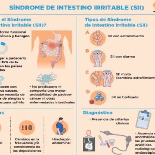 Síndrome de intestino irritable